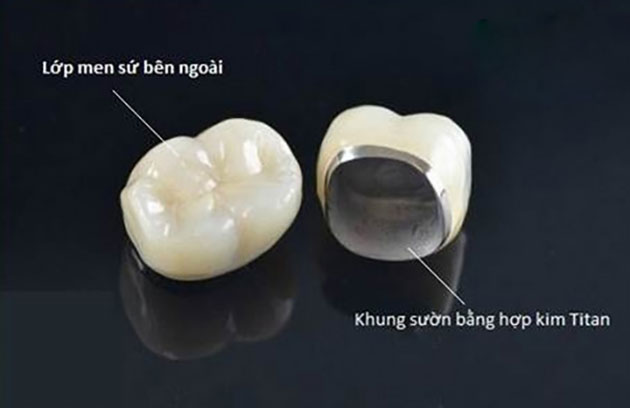 phuc-hinh-su-titan-14